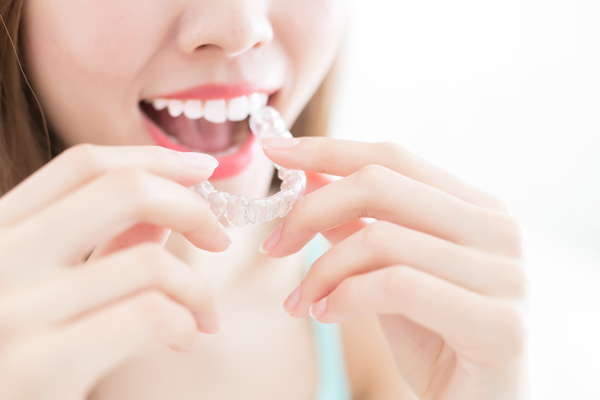 Ventajas Invisalign Barcelona