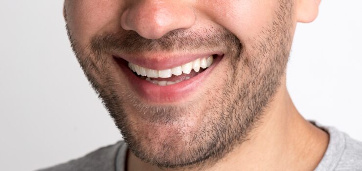 Invisalign Barcelona